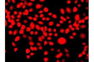 Immunofluorescence analysis of A549 cells using IFRD1 antibody (ABIN6291331). (IFRD1 抗体)