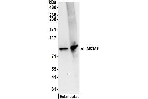 Western Blotting (WB) image for anti-Minichromosome Maintenance Complex Component 5 (MCM5) (AA 1-50) antibody (ABIN7454594) (MCM5 抗体  (AA 1-50))
