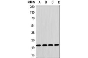 Western blot analysis of CD42c expression in Raji (A), HL60 (B), SP2/0 (C), rat heart (D) whole cell lysates. (GP1BB 抗体  (Center))