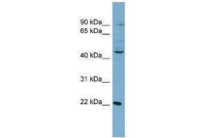 WB Suggested Anti-GOT1 Antibody   Titration: 1 ug/ml   Positive Control: NCI-H226 Whole Cell GOT1 is supported by BioGPS gene expression data to be expressed in NCIH226