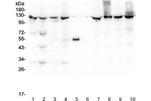 Western blot testing of 1) rat liver, 2) rat lung, 3) mouse liver, 4) mouse lung, 5) rabbit IgG, 6) molecular weight marker, 7) human HepG2, 8) human SMMC-7721, 9) human HeLa and 10) human Jurkat lysate with XPO1 antibody at 0. (XPO1 抗体  (AA 966-1071))