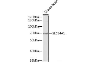 Western blot analysis of extracts of Mouse brain using SLC34A1 Polyclonal Antibody at dilution of 1:1000. (Solute Carrier Family 34 (Type II Sodium/phosphate Contransporter), Member 1 (SLC34A1) 抗体)