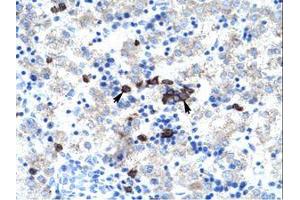 Image no. 1 for anti-Activator of Basal Transcription 1 (Abt1) (AA 174-223) antibody (ABIN202142) (Activator of Basal Transcription 1 抗体  (AA 174-223))
