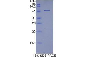 SDS-PAGE analysis of Pig VEGFA Protein. (VEGFA 蛋白)
