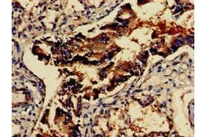 Immunohistochemistry of paraffin-embedded human lung tissue using ABIN7153954 at dilution of 1:100 (GAD65 抗体  (AA 1-82))