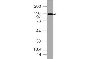 Image no. 1 for anti-Integrin, alpha X (Complement Component 3 Receptor 4 Subunit) (ITGAX) (AA 620-835) antibody (ABIN5027084) (CD11c 抗体  (AA 620-835))