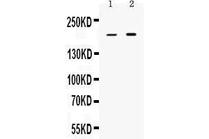 Western blot analysis of Periplakin expression in rat stomach extract ( Lane 1) and HELA whole cell lysates ( Lane 2). (PPL 抗体  (C-Term))