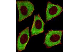 Fluorescent image of  cells stained with YWHAZ Antibody (ABIN1882058 and ABIN2838497). (14-3-3 zeta 抗体)