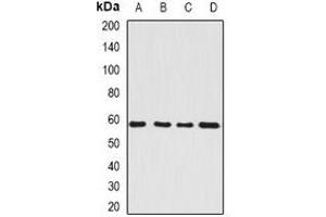 Western blot analysis of SerRS expression in HepG2 (A), Hela (B), mouse kidney (C), rat brain (D) whole cell lysates. (Seryl-tRNA Synthetase (SARS) 抗体)