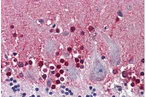 Human Brain, Cerebellum: Formalin-Fixed, Paraffin-Embedded (FFPE) (CBS 抗体  (AA 1-101))