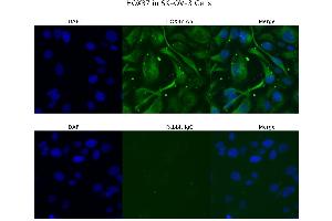 Sample Type : SKOV3  Primary Antibody Dilution: 4 ug/ml  Secondary Antibody : Anti-rabbit Alexa 546  Secondary Antibody Dilution: 2 ug/ml  Gene Name : HOXB7 (HOXB7 抗体  (C-Term))
