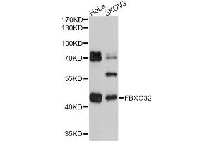 Western blot analysis of extracts of various cell lines, using FBXO32 antibody (ABIN1872667) at 1:2000 dilution. (FBXO32 抗体)