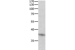 Western Blot analysis of Jurkat cell using DUSP12 Polyclonal Antibody at dilution of 1:500 (DUSP12 抗体)