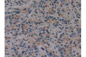 Immunohistochemistry (IHC) image for anti-Polycystic Kidney Disease 1 (Autosomal Dominant) (PKD1) (AA 651-876) antibody (ABIN2119727)