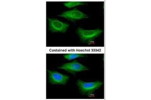 ICC/IF Image Immunofluorescence analysis of paraformaldehyde-fixed HeLa, using beta Tubulin 2, antibody at 1:200 dilution. (TUBB2A 抗体)
