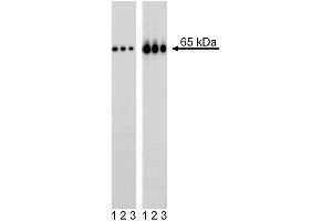 Western blot analysis of NF-kappaB p65 (pS529) in transformed human epithelioid carcinoma.