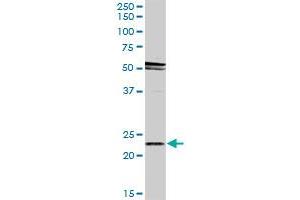 RAB31 MaxPab rabbit polyclonal antibody. (RAB31 抗体  (AA 1-195))