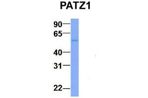 Host:  Rabbit  Target Name:  PATZ1  Sample Type:  Human Adult Placenta  Antibody Dilution:  1. (PATZ1 抗体  (N-Term))