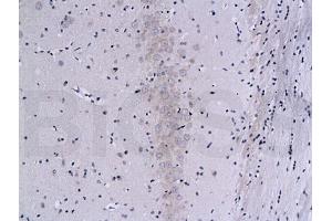 Formalin-fixed and paraffin embedded rat brain labeled with Mouse Anti-Calcineurin A/PP-2B alpha 1 Polyclonal Antibody (ABIN723890), Unconjugated 1:200 followed by conjugation to the secondary antibody and DAB staining (Calcineurin A 抗体  (AA 15-80))