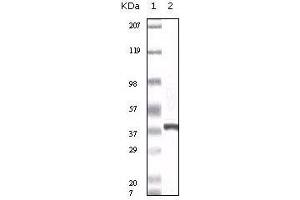 Western blot analysis using calcyclin mouse mAb against truncated calcyclin recombinant protein.