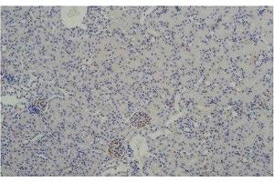 Immunohistochemistry of paraffin-embedded Mouse kidney tissue using TBP Monoclonal Antibody at dilution of 1:200. (TBP 抗体)