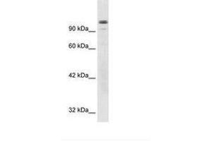 Image no. 3 for anti-General Transcription Factor III (GTF2I) (AA 208-257) antibody (ABIN6735929) (GTF2I 抗体  (AA 208-257))