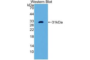 Western blot analysis of the recombinant protein. (PLAP 抗体  (AA 68-313))