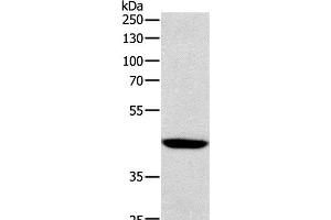 Western Blot analysis of Human lymphoma tissue using SOX-7 Polyclonal Antibody at dilution of 1:1100 (SOX7 抗体)