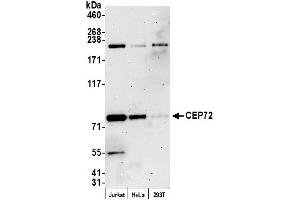 Western Blotting (WB) image for anti-Centrosomal Protein 72kDa (CEP72) (AA 150-200) antibody (ABIN7449875)