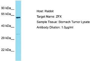 Host: Rabbit Target Name: ZFX Sample Type: Stomach Tumor lysates Antibody Dilution: 1. (ZFX 抗体  (C-Term))