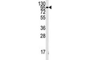 Western blot analysis of FGFR antibody and K562 lysate. (FGFR1 抗体  (AA 132-161))