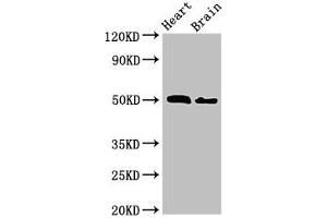 Western Blot Positive WB detected in: Mouse heart tissue, Mouse brain tissue All lanes: VPS4B antibody at 2. (VPS4B 抗体  (AA 1-117))