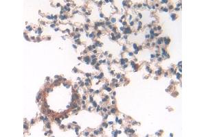 Used in DAB staining on fromalin fixed paraffin- embedded lung tissue (GM-CSF 抗体  (AA 19-141))