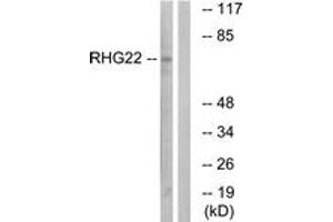 Western blot analysis of extracts from K562 cells, using RHG22 Antibody. (ARHGAP22 抗体  (AA 565-614))