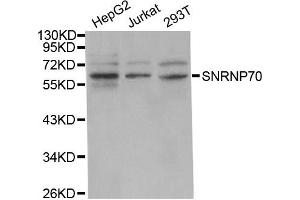 Western Blotting (WB) image for anti-Small Nuclear Ribonucleoprotein 70kDa (U1) (SNRNP70) antibody (ABIN1877092) (SNRNP70 抗体)