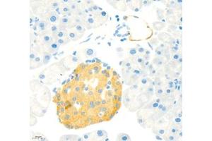 Immunohistochemistry (Paraffin-embedded Sections) (IHC (p)) image for anti-Mucosal Vascular Addressin Cell Adhesion Molecule 1 (MADCAM1) antibody (ABIN7074695)