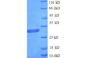 SDS-PAGE (SDS) image for Guanidinoacetate N-Methyltransferase (GAMT) (AA 1-236) protein (His tag) (ABIN7584413)