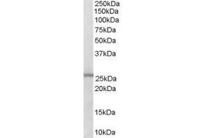 Western Blotting (WB) image for anti-Glutathione S-Transferase mu 1/2 (GSTM1/2) (C-Term) antibody (ABIN393122) (GSTM1/2 抗体  (C-Term))