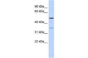 WB Suggested Anti-CETP Antibody Titration: 0. (CETP 抗体  (Middle Region))