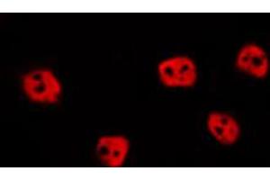 ABIN6274015 staining HepG2 by IF/ICC. (EPAS1 抗体  (Internal Region))