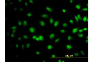 Immunofluorescence of monoclonal antibody to TCEB3 on HeLa cell.