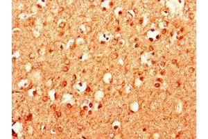 Immunohistochemistry of paraffin-embedded human brain tissue using ABIN7158987 at dilution of 1:100 (MPDU1 抗体  (AA 1-36))