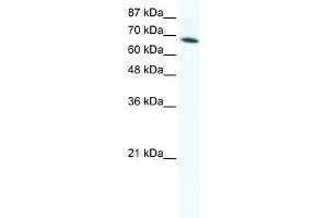 WB Suggested Anti-DDX1 Antibody Titration:  1. (DDX1 抗体  (C-Term))