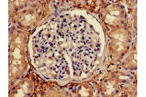 Immunohistochemistry of paraffin-embedded human kidney tissue using ABIN7174772 at dilution of 1:100 (NMNAT2 抗体  (AA 1-183))