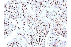 FFPE human testicular carcinoma tested with Histone antibody (AE-4) (Histone 抗体)