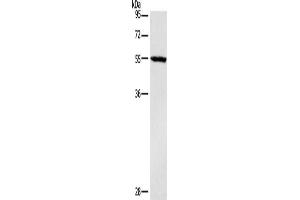 Gel: 10 % SDS-PAGE, Lysate: 40 μg, Lane: Mouse heart tissue, Primary antibody: ABIN7190465(DGAT1 Antibody) at dilution 1/1400, Secondary antibody: Goat anti rabbit IgG at 1/8000 dilution, Exposure time: 40 seconds (DGAT1 抗体)