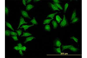 Immunofluorescence (IF) image for anti-NIMA (Never in Mitosis Gene A)- Related Kinase 9 (NEK9) (AA 226-326) antibody (ABIN566652)