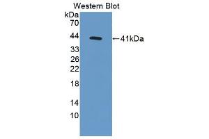 Western blot analysis of the recombinant protein. (MSMB 抗体  (AA 21-113))