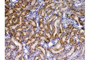 IHC analysis of TIMP4 using anti- TIMP4 antibody . (TIMP4 抗体  (AA 174-224))