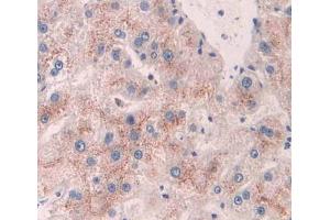 Used in DAB staining on fromalin fixed paraffin- embedded liver tissue (ACAA1 抗体  (AA 182-424))